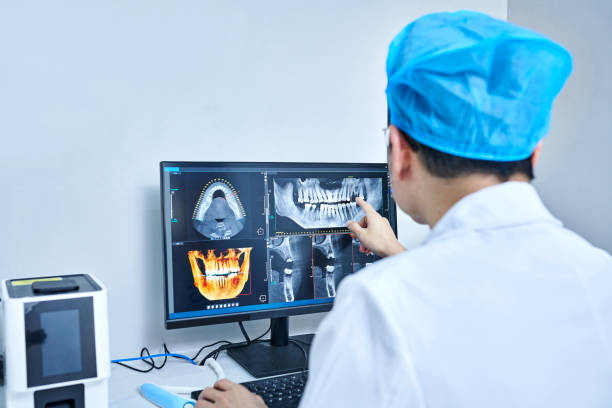 Best Emergency Wisdom Teeth Removal in San Leon, TX